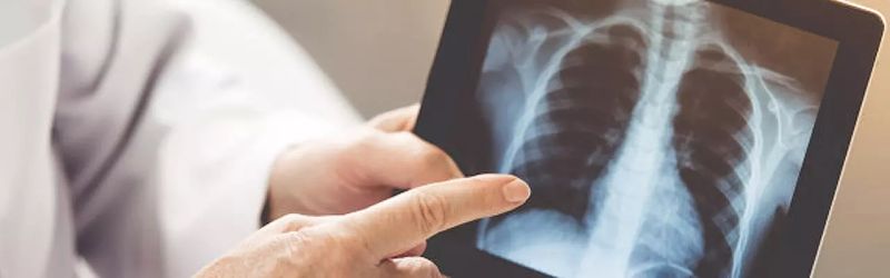 Pulmologija i bolesti pluća