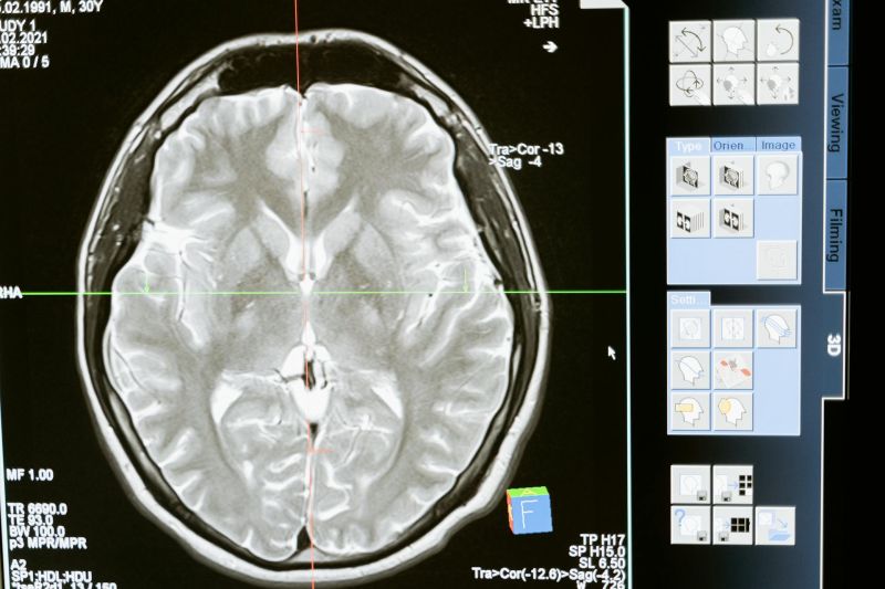 Nova MR tehnologija omogućava jasnije snimke oka i mozga