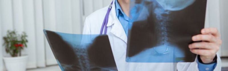 Magnetna rezonanca vrata