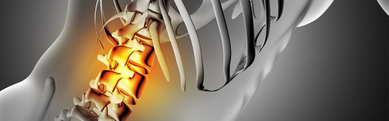 Magnetna rezonanca kičme