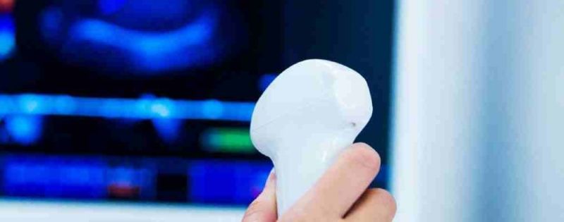 Kolor dopler pregled