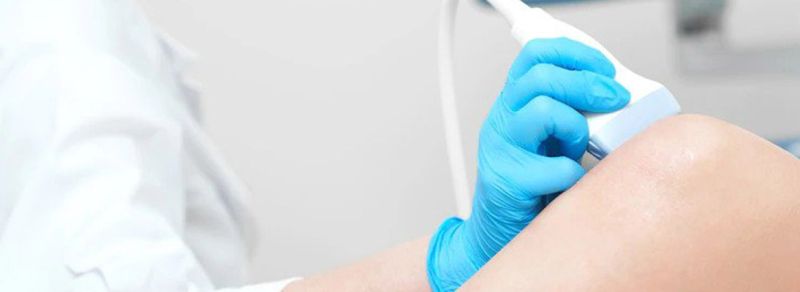 Kolor dopler pregled