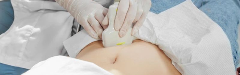 Ultrazvuk mekih tkiva