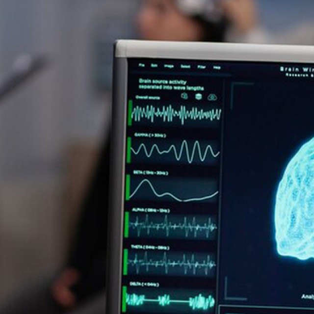 Neurologija - ekran sa prikazom mozga