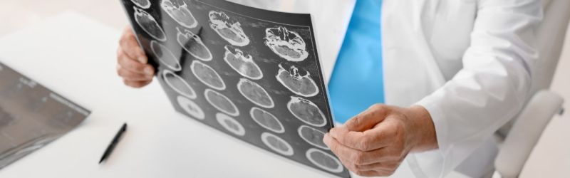 Encefalitis - Upala mozga