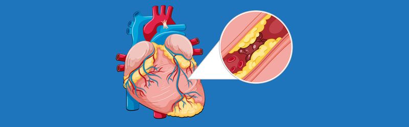 Vaskularna hirurgija