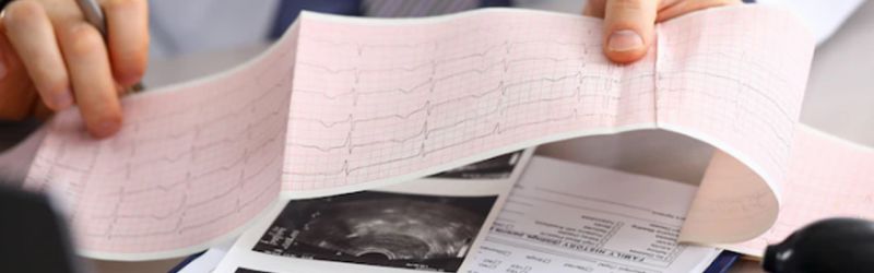 Kardiološki pregled