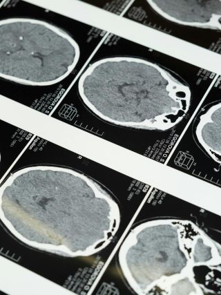Neurologija