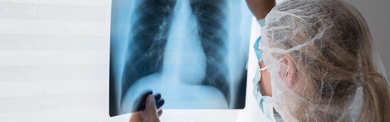 Maligni tumor pluća