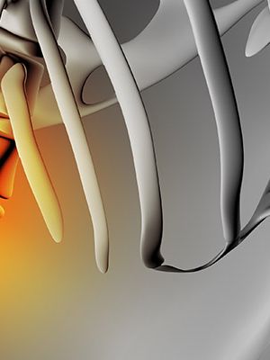 Magnetna rezonanca kičme