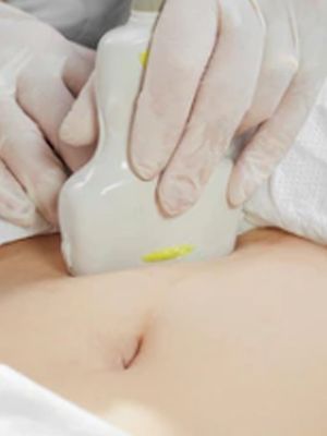 Ultrazvuk mekih tkiva