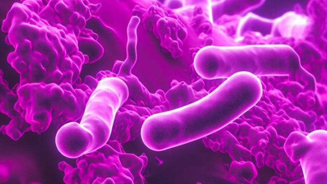 Tuberkuloza: Uzroci, simptomi i lečenje Tuberkuloza: Uzroci, simptomi i lečenje