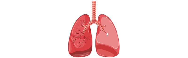 Pneumotoraks