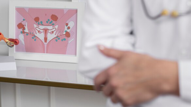 Razumevanje endometrioze jajnika: Simptomi, dijagnoza i lečenje Razumevanje endometrioze jajnika: Simptomi, dijagnoza i lečenje