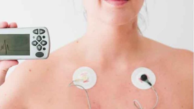 Holter EKG-a i holter pritiska Holter EKG-a i holter pritiska