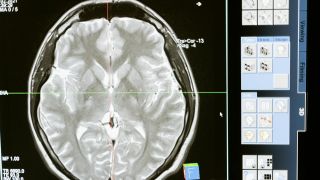 Nova antena za magnetnu rezonancu donosi detaljnije snimke oka, mozga i drugih organa Nova antena za magnetnu rezonancu donosi detaljnije snimke oka, mozga i drugih organa