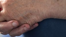 Osteoartritis: Vodič kroz bolest zglobova