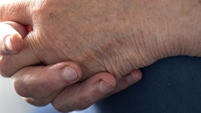 Osteoartritis: Vodič kroz bolest zglobova Osteoartritis: Vodič kroz bolest zglobova
