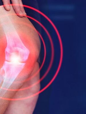 Magnetna rezonanca kolena