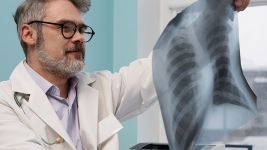 Uzroci i simptomi frakture rebara