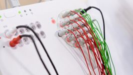 Elektroencefalografija - EEG snimanje