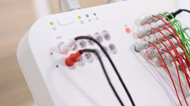Elektroencefalografija - EEG snimanje Elektroencefalografija - EEG snimanje