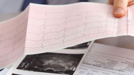 Važnost redovnih kardioloških pregleda