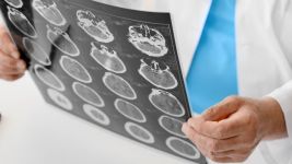 Encefalitis: Uzroci, Simptomi i Tretmani