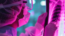 Stenoza plućne arterije: uzroci, dijagnoza i terapija