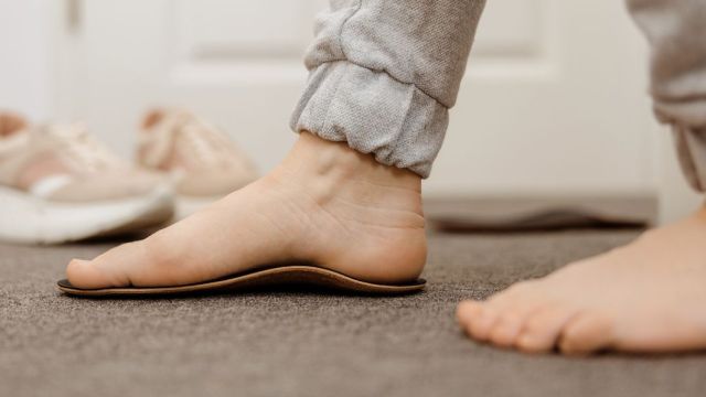 Ravna stopala: Simptomi, dijagnoza i terapija Ravna stopala: Simptomi, dijagnoza i terapija