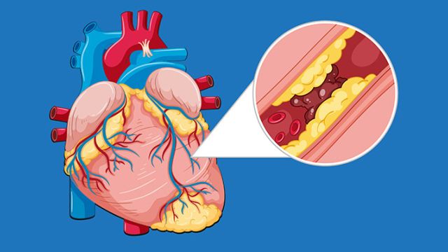 Vaskularna hirurgija: Uvod u tretman krvnih sudova Vaskularna hirurgija: Uvod u tretman krvnih sudova