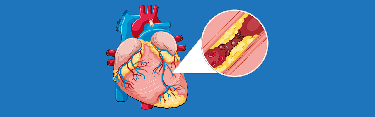 Vaskularna hirurgija