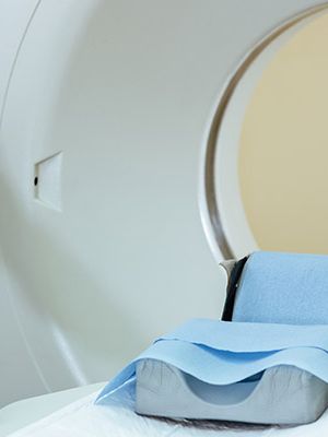 Magnetna rezonanca angiografija