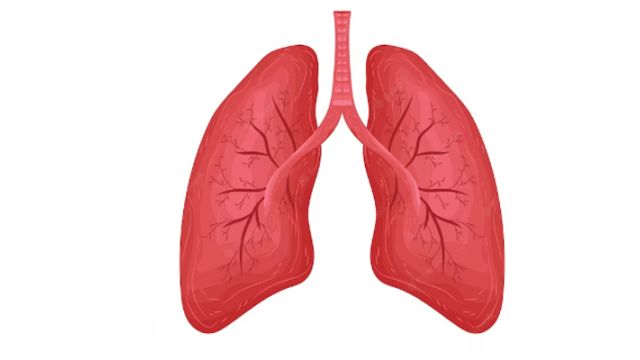 Razumevanje bronhiektazija: Uzroci, simptomi i lečenje Razumevanje bronhiektazija: Uzroci, simptomi i lečenje